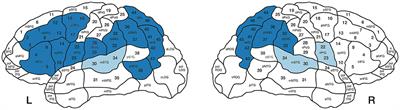 Mapping Verb Retrieval With nTMS: The Role of Transitivity